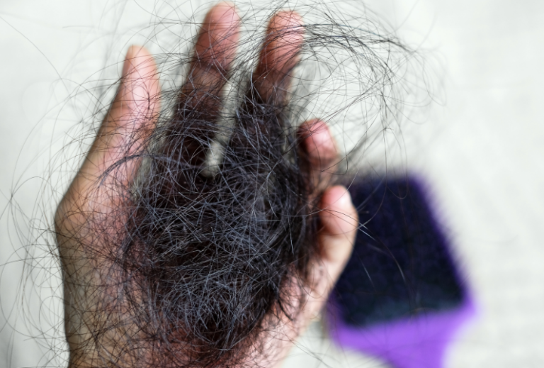 Hair Loss: Understanding Causes, Treatments, and Managing Self-Perception